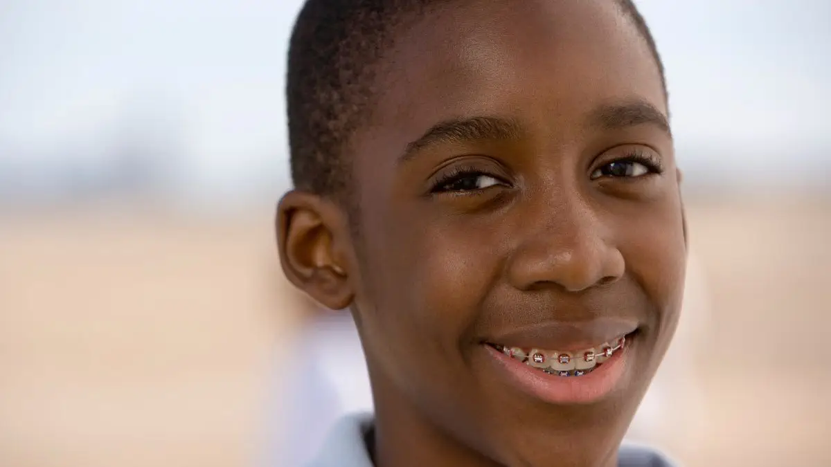 The Best Braces Colors - Best Braces Colors For Boys